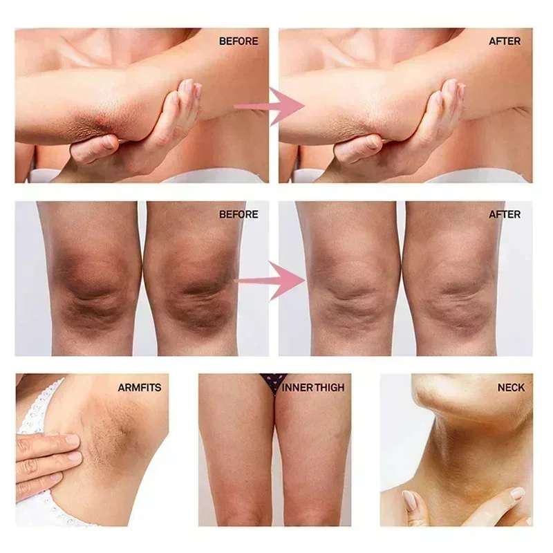 كريم تفتيح منطقة تحت الإبط بال - مراجعة Anti-Aging Face Cream وسعره